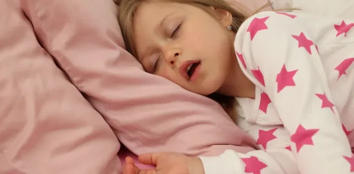 Young girl snoring with mouth open while sleeping, illustrating signs of sleep-disordered breathing in children and pediatric airway issues.