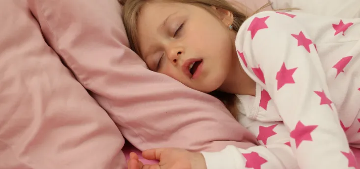 Young girl snoring with mouth open while sleeping, illustrating signs of sleep-disordered breathing in children and pediatric airway issues.