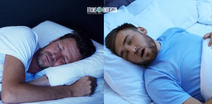 Mouth Breathing vs Nasal Breathing for Your Smile comparison of two sleeping men breathing differently