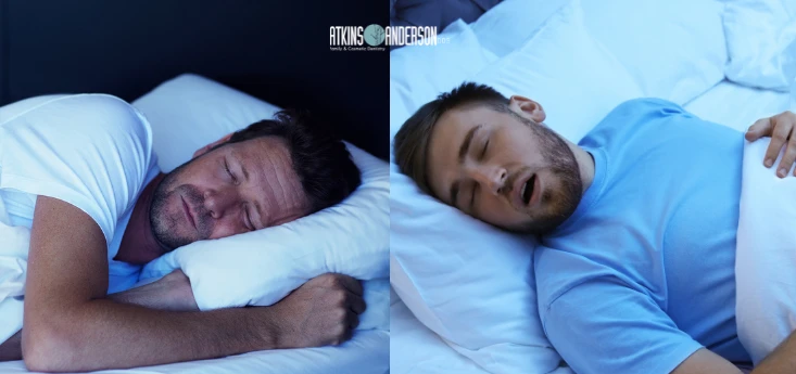 Mouth Breathing vs Nasal Breathing for Your Smile comparison of two sleeping men breathing differently