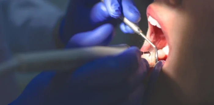 Preventive dentistry appointment for long-term oral health at Atkins & Anderson DDS