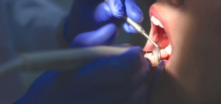 Preventive dentistry appointment for long-term oral health at Atkins & Anderson DDS