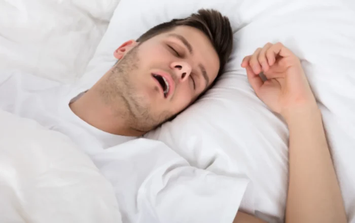 Why Do I Snore? Snoring & Sleep Apnea. Man in white t-shirt snoring in on back on white bed.
